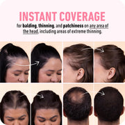 Boldify Hairline Powder, Root Touch Up Hair Color Dark Brown 4g | Instantly Fills Thinning Hair & Sparse Hairlines - Root Cover Up for Gray Hair - Water-Resistant, Sweat-Proof 24-Hour Wear