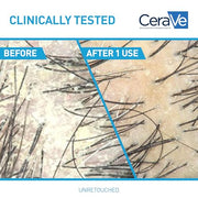 CeraVe Hydrating Anti Dandruff Shampoo, Itchy Scalp Treatment, 12oz | Helps Eliminate Flakes with 1% Pyrithione Zinc, Hyaluronic Acid, Niacinamide and Ceramides In A Sulfate Free Formula