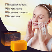 VALITIC Kojic Acid Dark Spot Remover Soap Bars, Turmeric Bar Soaps 2 Pack | Original Face and Body Wash Bath Soap for Women and Men with Vitamin C, Retinol, Collagen, Hyaluronic Acid, Shea, Olive Oil