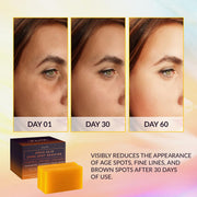 VALITIC Kojic Acid Dark Spot Remover Soap Bars, Turmeric Bar Soaps 2 Pack | Original Face and Body Wash Bath Soap for Women and Men with Vitamin C, Retinol, Collagen, Hyaluronic Acid, Shea, Olive Oil