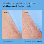 Peach Slices - Smoothing Solution Ingrown Hair Treatment (1.69 oz) - Smooth, Relieve, Soften Skin - 360 Roller - BHA, AHA, PHA, Niacinamide, Licorice - Vegan & Cruelty Free - Korean Skin Care & Beauty