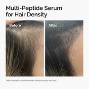 The Ordinary Multi-Peptide Serum for Hair Density, Peptide-Powered Formula for Thicker, Fuller Looking Hair