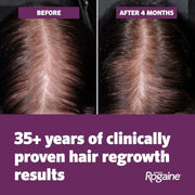Women's Rogaine 5% Minoxidil Topical Foam, Unscented, 2 x 2.11 oz | Once-a-Day Hair Loss Treatment for Women, Regrow Fuller, Thicker Hair, Unscented, 4-Month Supply