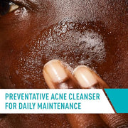 CeraVe Acne Control Cleanser, Face Wash with 2% Salicylic Acid, 16 oz